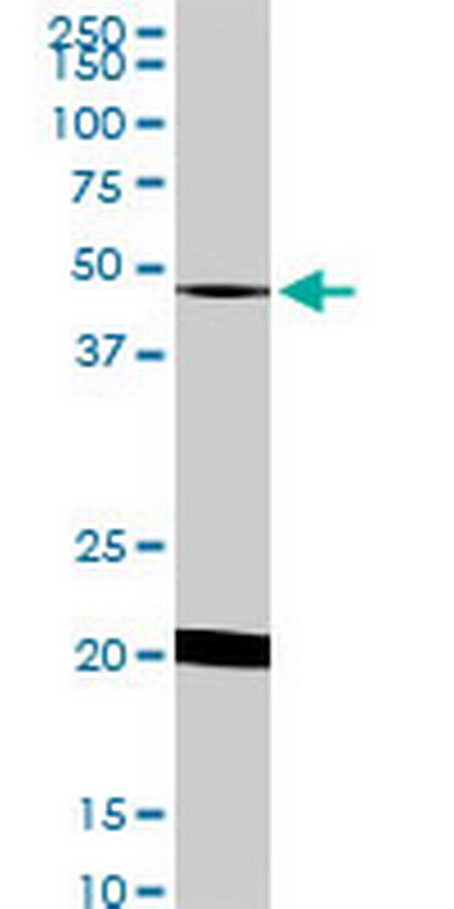 NADK Antibody in Western Blot (WB)