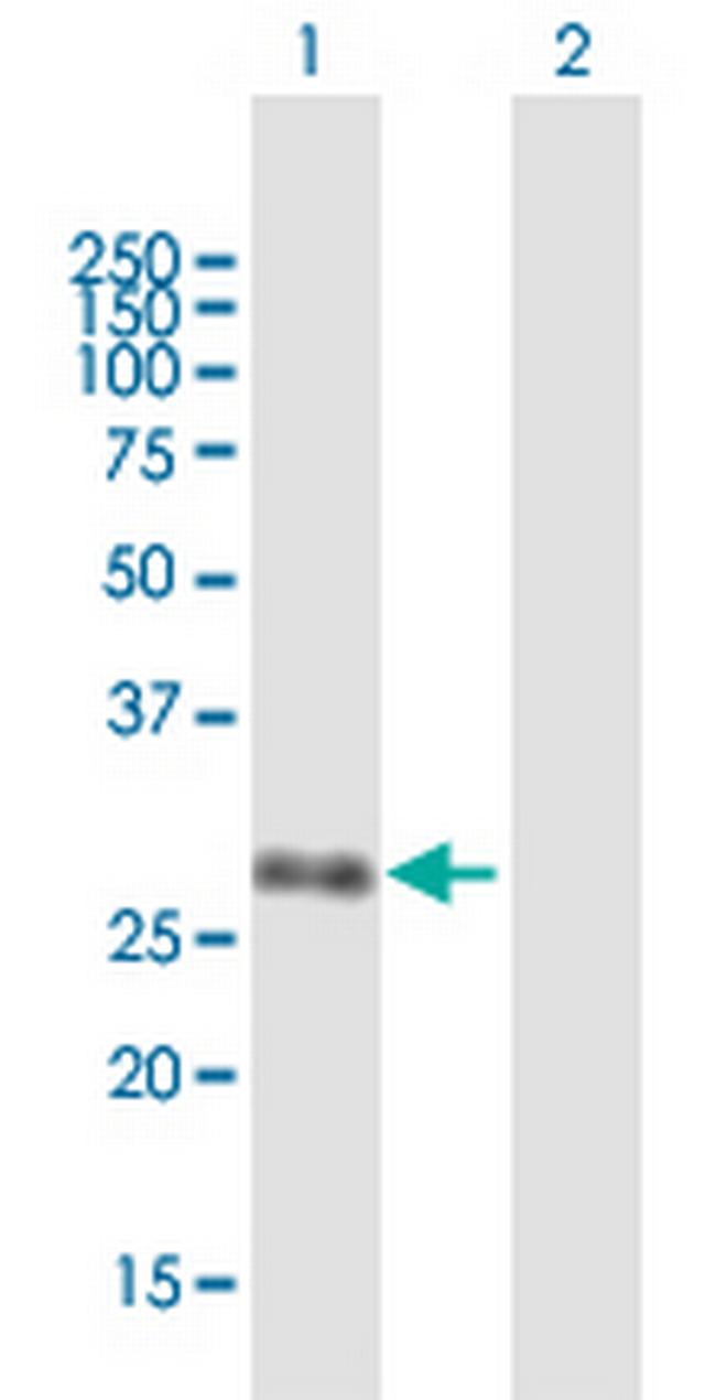 UBE2Z Antibody in Western Blot (WB)