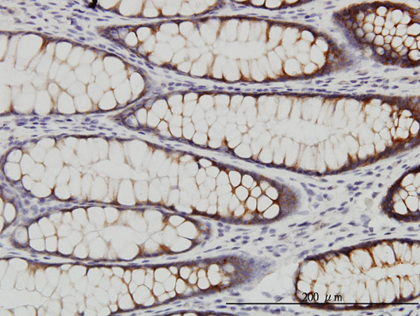 WNK2 Antibody in Immunohistochemistry (Paraffin) (IHC (P))