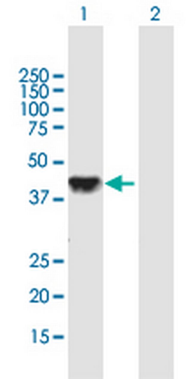 DLK2 Antibody in Western Blot (WB)