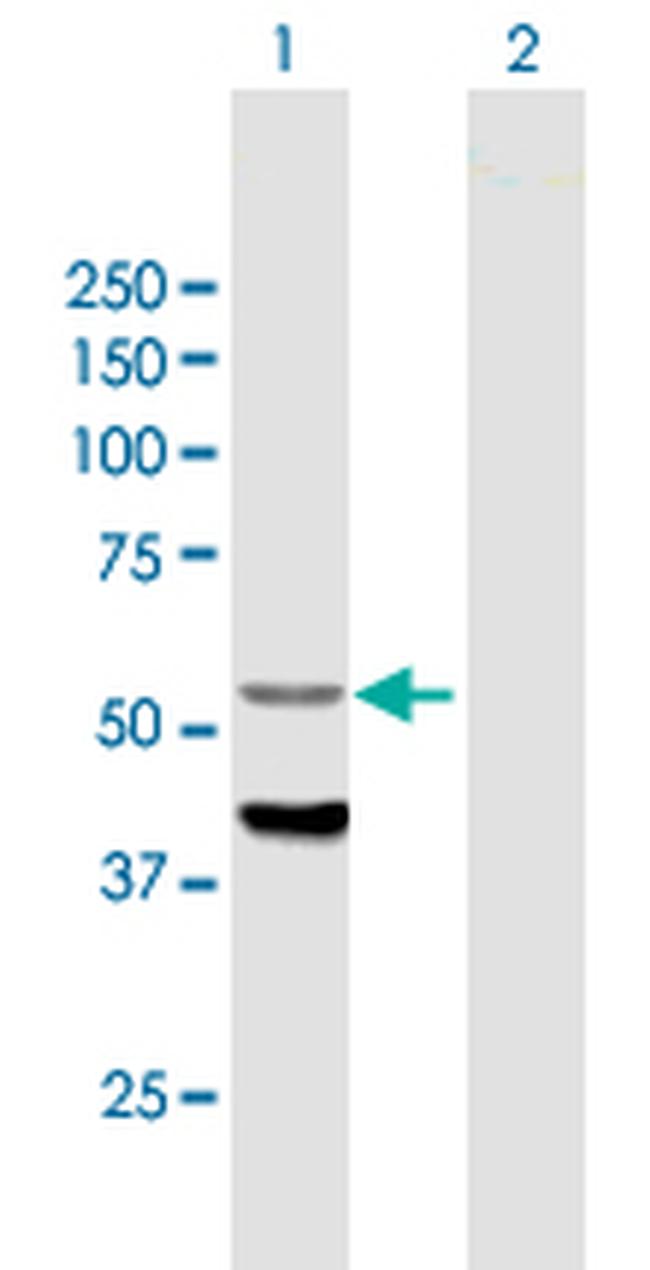 CYP4F12 Antibody in Western Blot (WB)