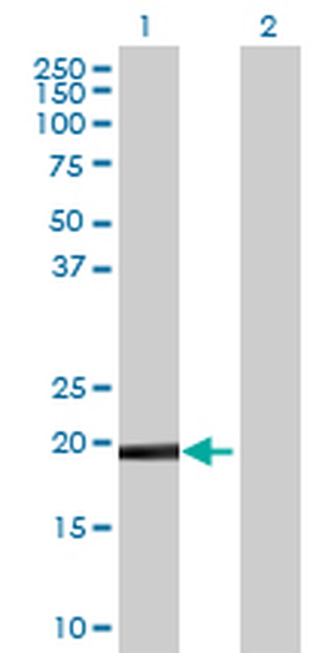 DUSP26 Antibody in Western Blot (WB)