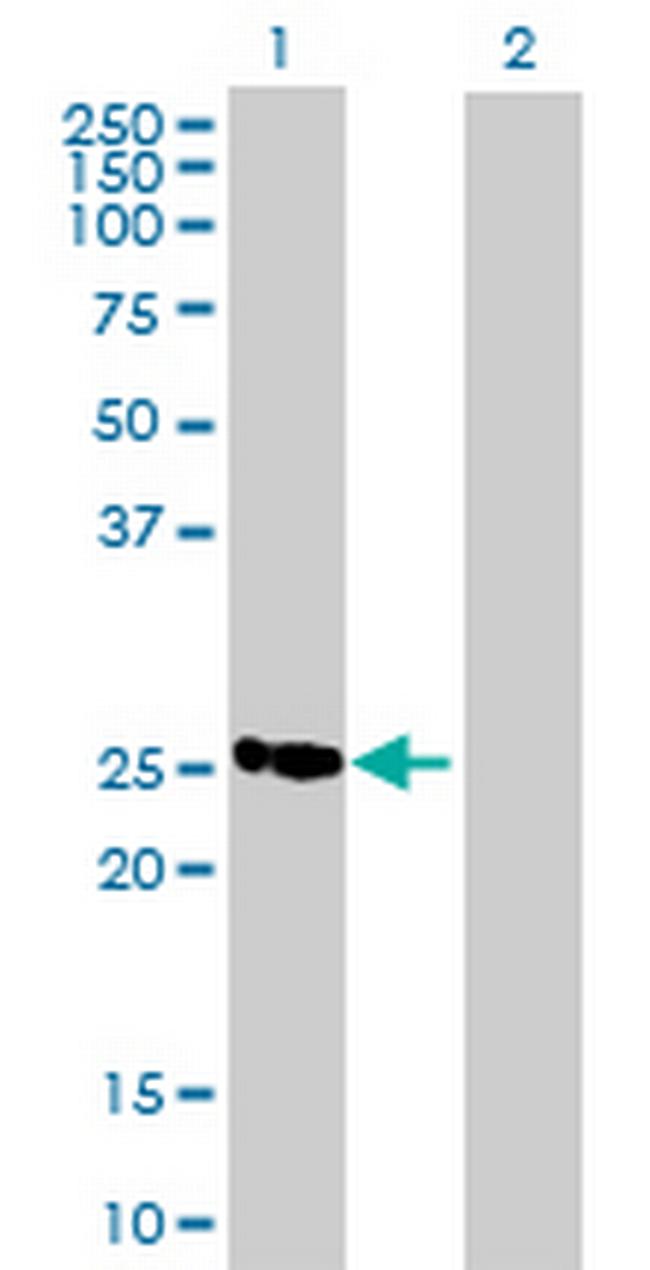 MGC2803 Antibody in Western Blot (WB)