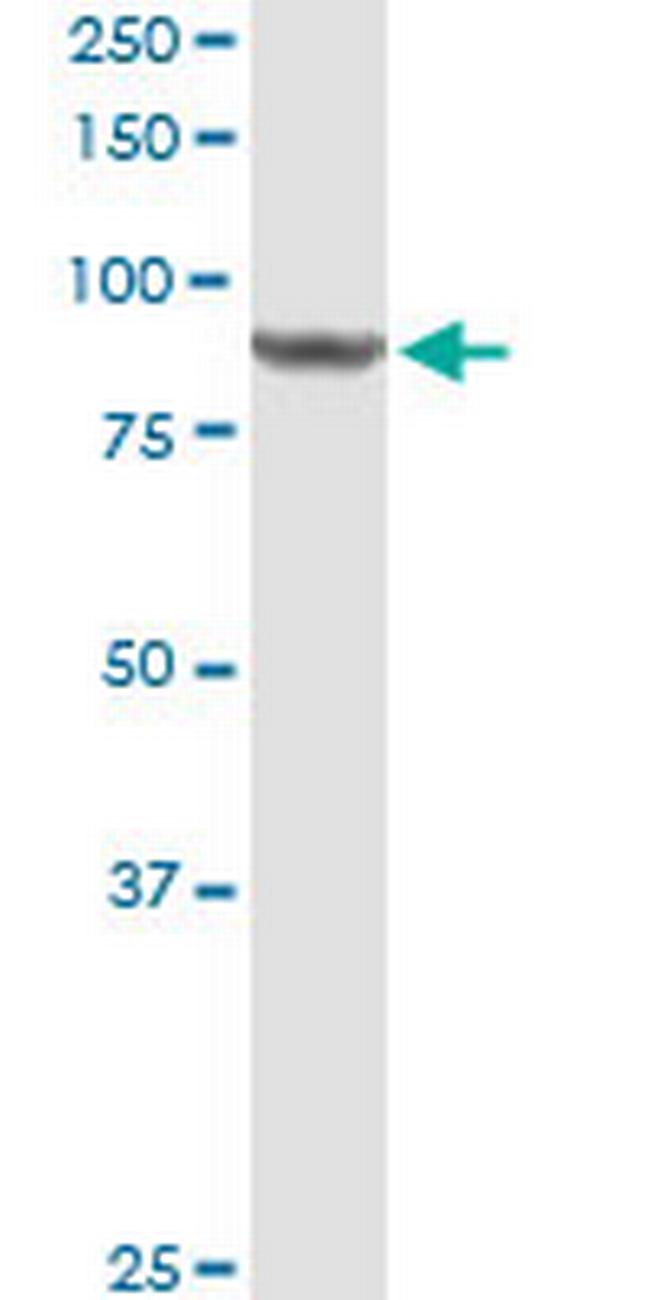 DDX50 Antibody in Western Blot (WB)