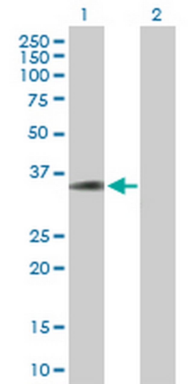 C20orf195 Antibody in Western Blot (WB)