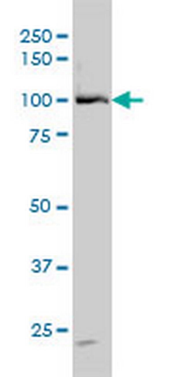 DDX54 Antibody in Western Blot (WB)