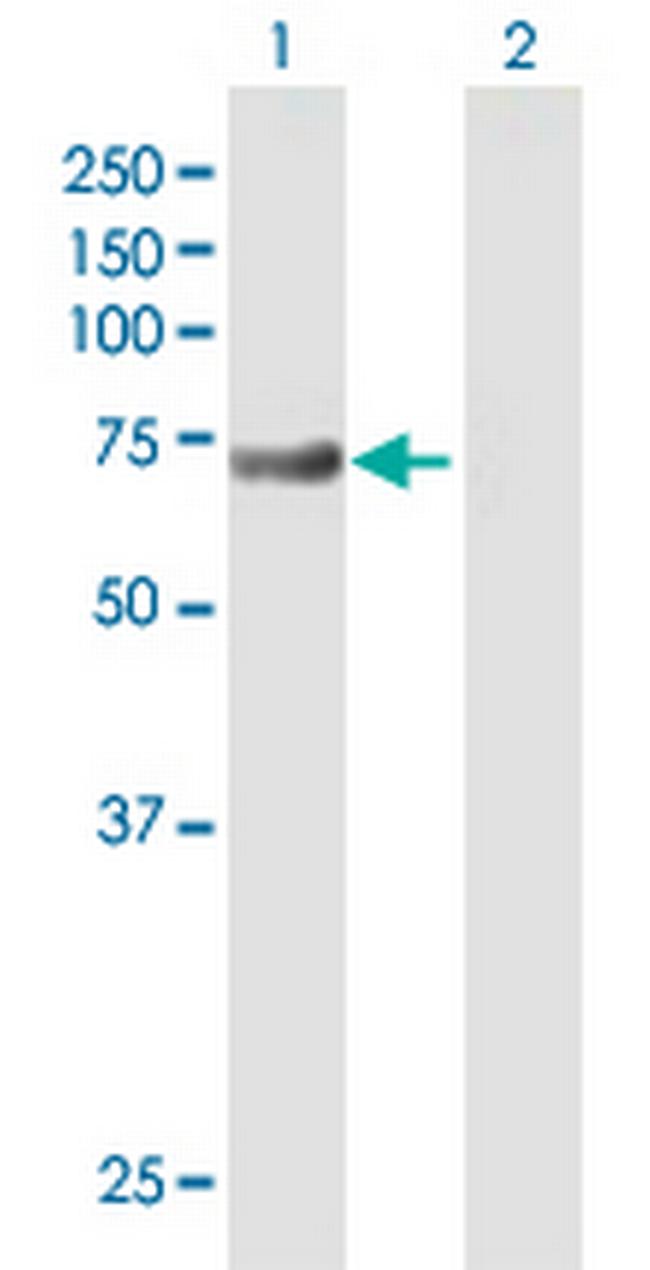 DHX58 Antibody in Western Blot (WB)