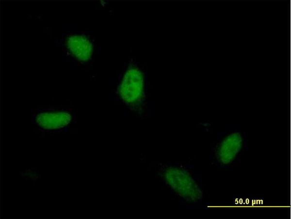 ZSCAN5A Antibody in Immunocytochemistry (ICC/IF)