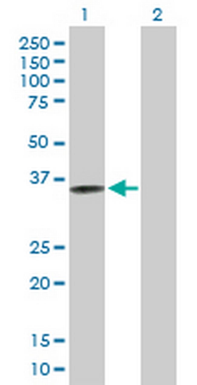 CRELD2 Antibody in Western Blot (WB)