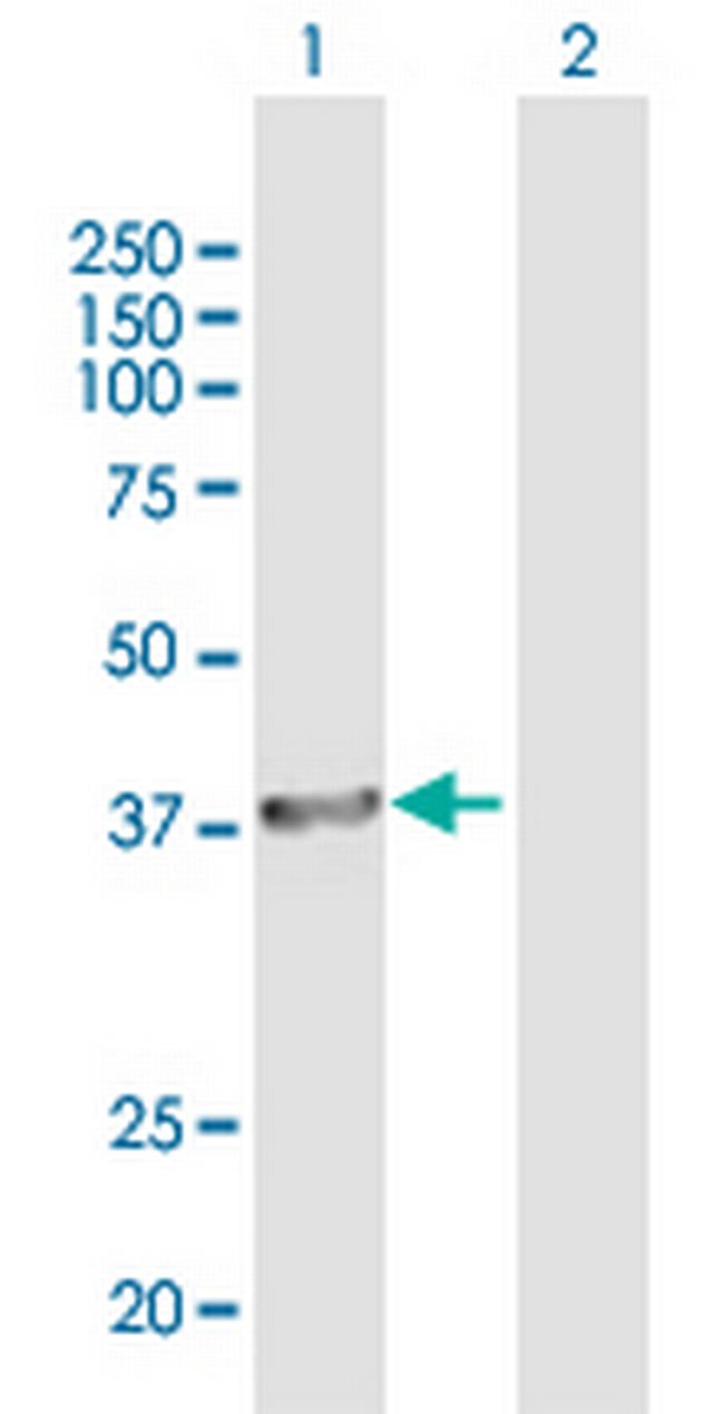 BRCC3 Antibody in Western Blot (WB)