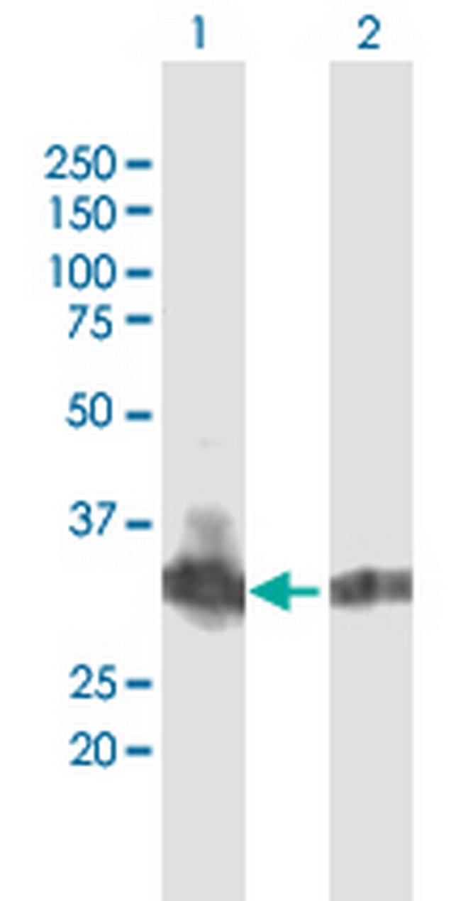 B3GNT4 Antibody in Western Blot (WB)