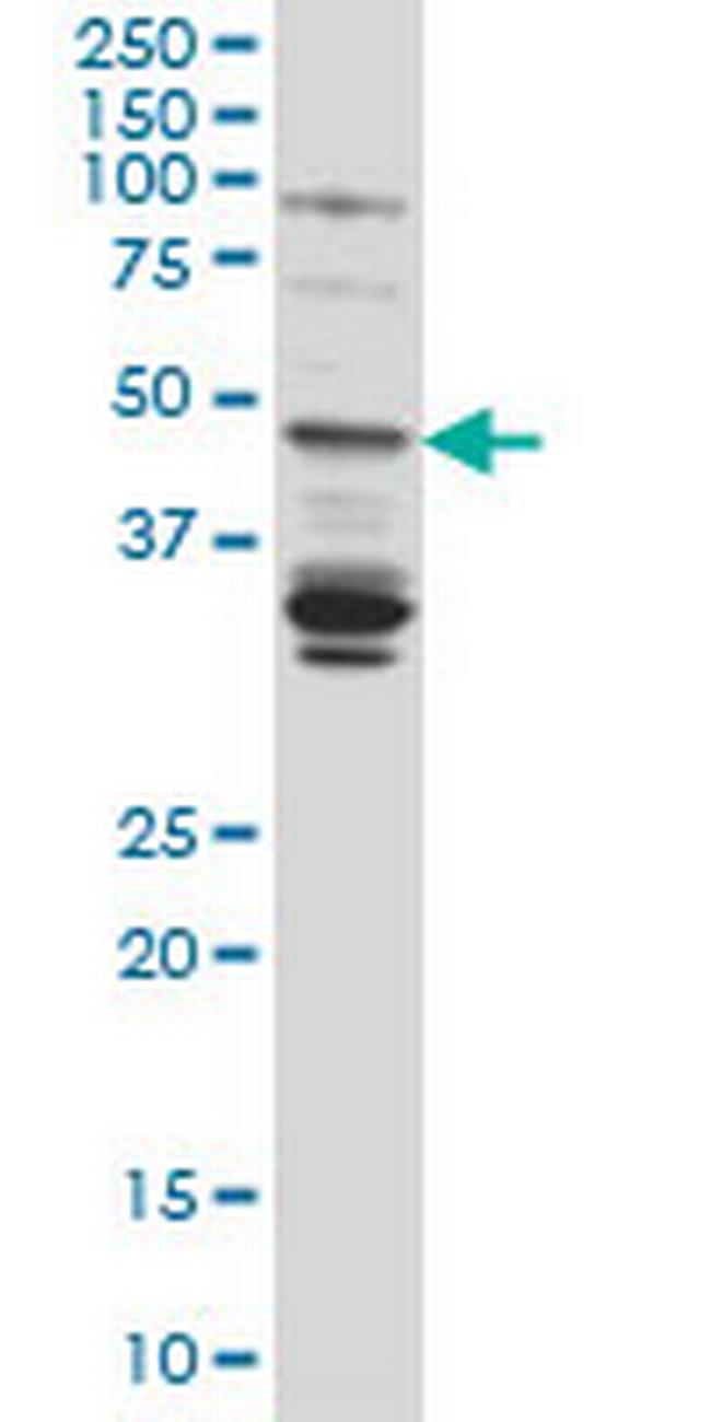 LASS4 Antibody in Western Blot (WB)