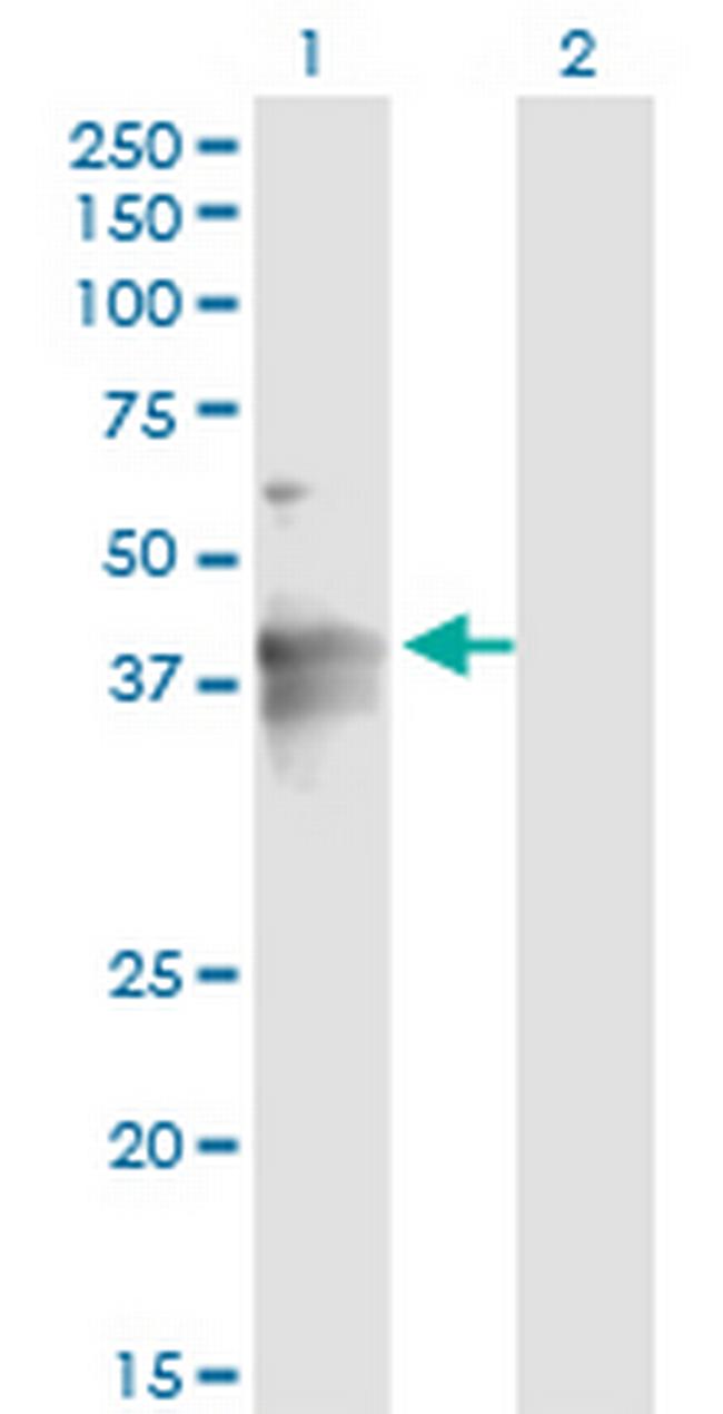 LASS4 Antibody in Western Blot (WB)