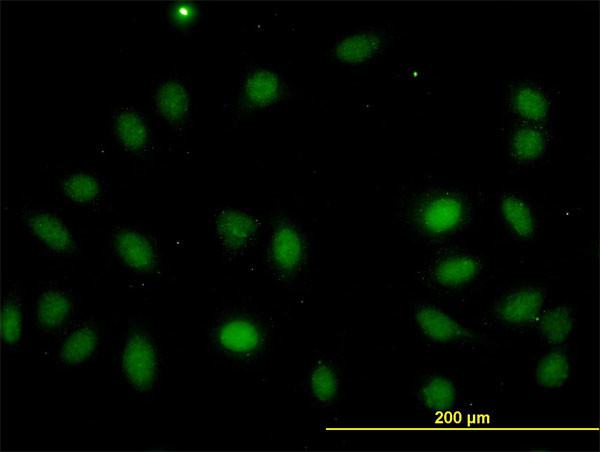 LASS4 Antibody in Immunocytochemistry (ICC/IF)