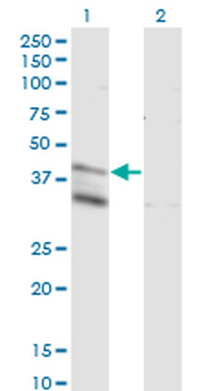 LASS4 Antibody in Western Blot (WB)