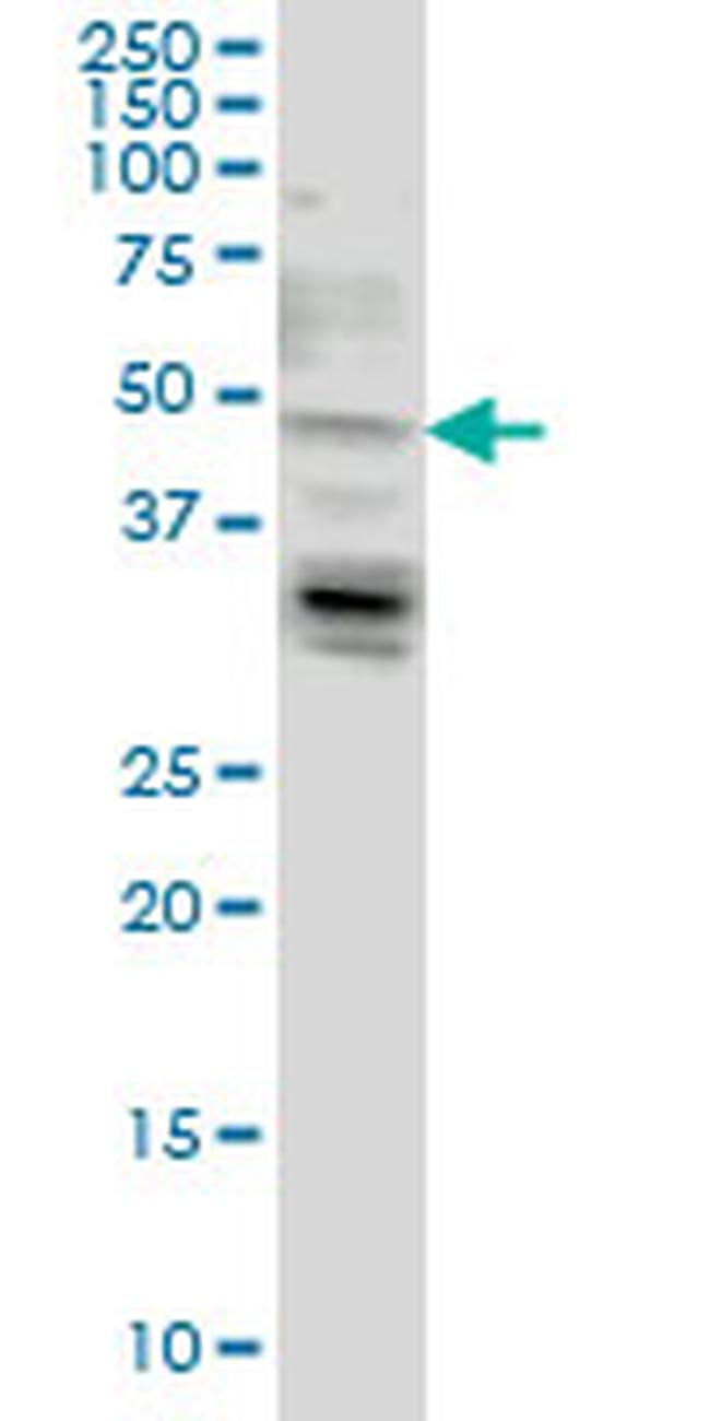LASS4 Antibody in Western Blot (WB)
