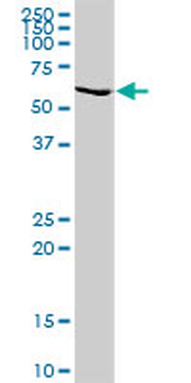 GALNT14 Antibody in Western Blot (WB)