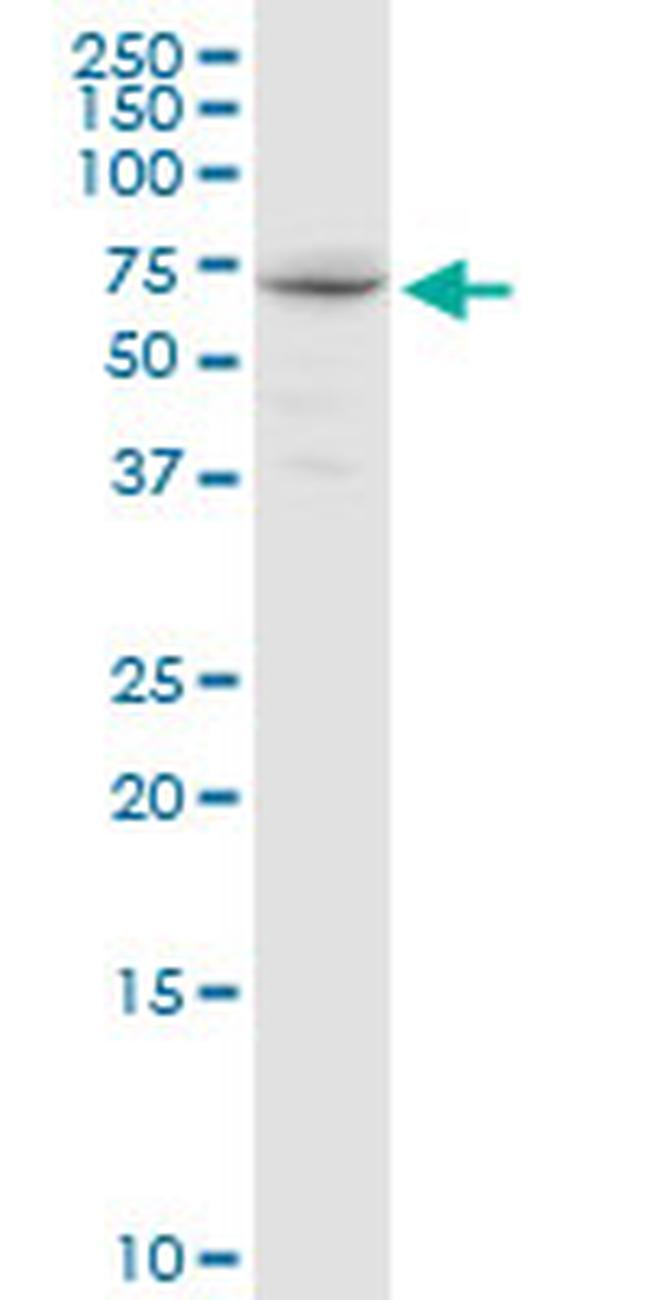 GALNT14 Antibody in Western Blot (WB)