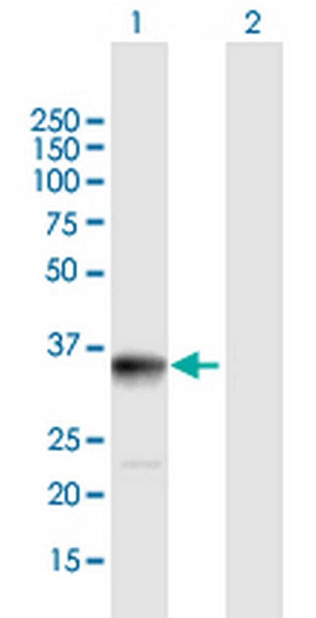 PPP1R3B Antibody in Western Blot (WB)