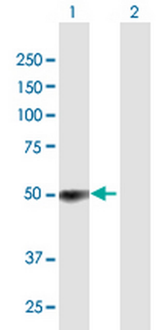 ZCCHC6 Antibody in Western Blot (WB)