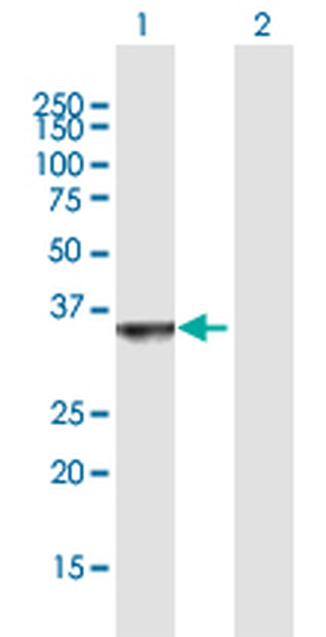 OGFOD2 Antibody in Western Blot (WB)