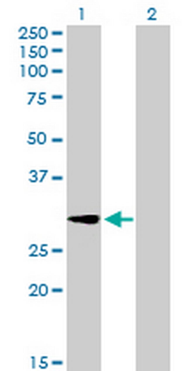 GALNT12 Antibody in Western Blot (WB)