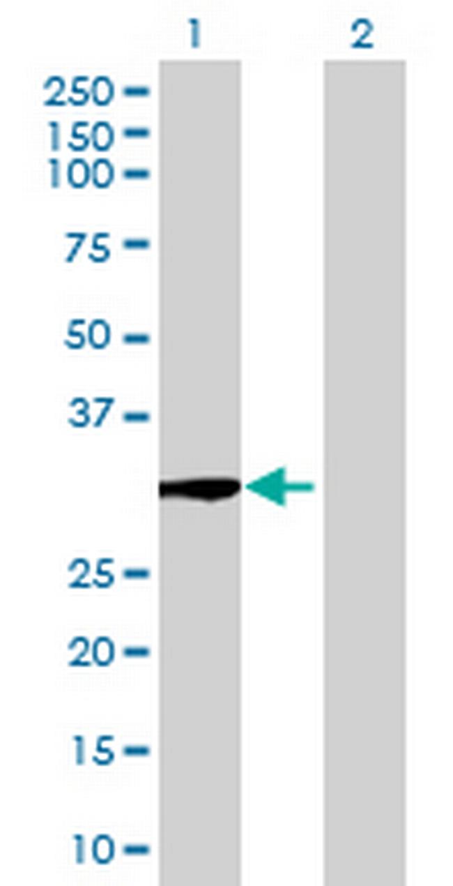 GALNT12 Antibody in Western Blot (WB)