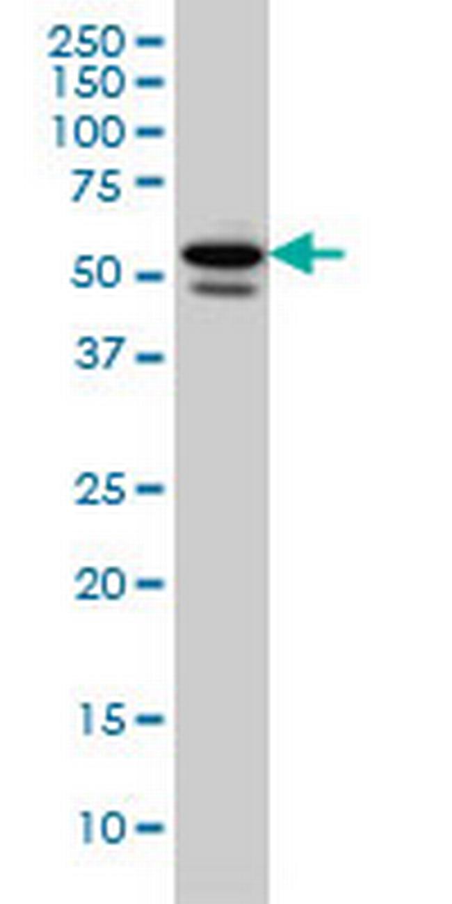 TBL1XR1 Antibody in Western Blot (WB)