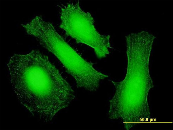 LIN28 Antibody in Immunocytochemistry (ICC/IF)