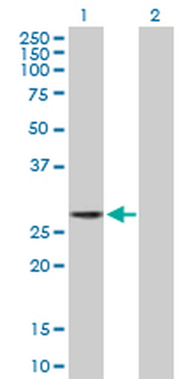 LIN28 Antibody in Western Blot (WB)