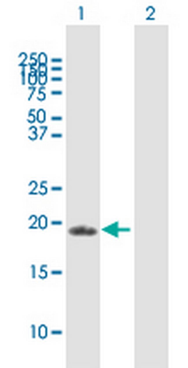 ZFAND1 Antibody in Western Blot (WB)