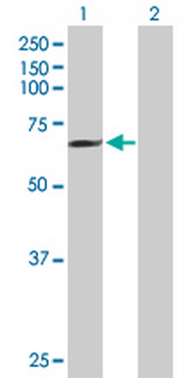 MCTP1 Antibody in Western Blot (WB)