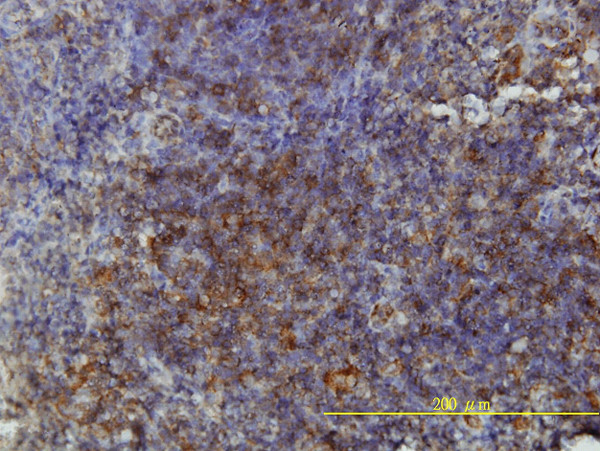 GSDMD Antibody in Immunohistochemistry (Paraffin) (IHC (P))