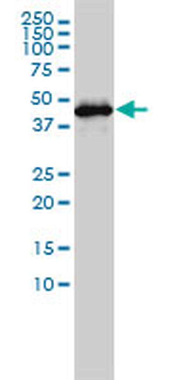GSDMD Antibody in Western Blot (WB)