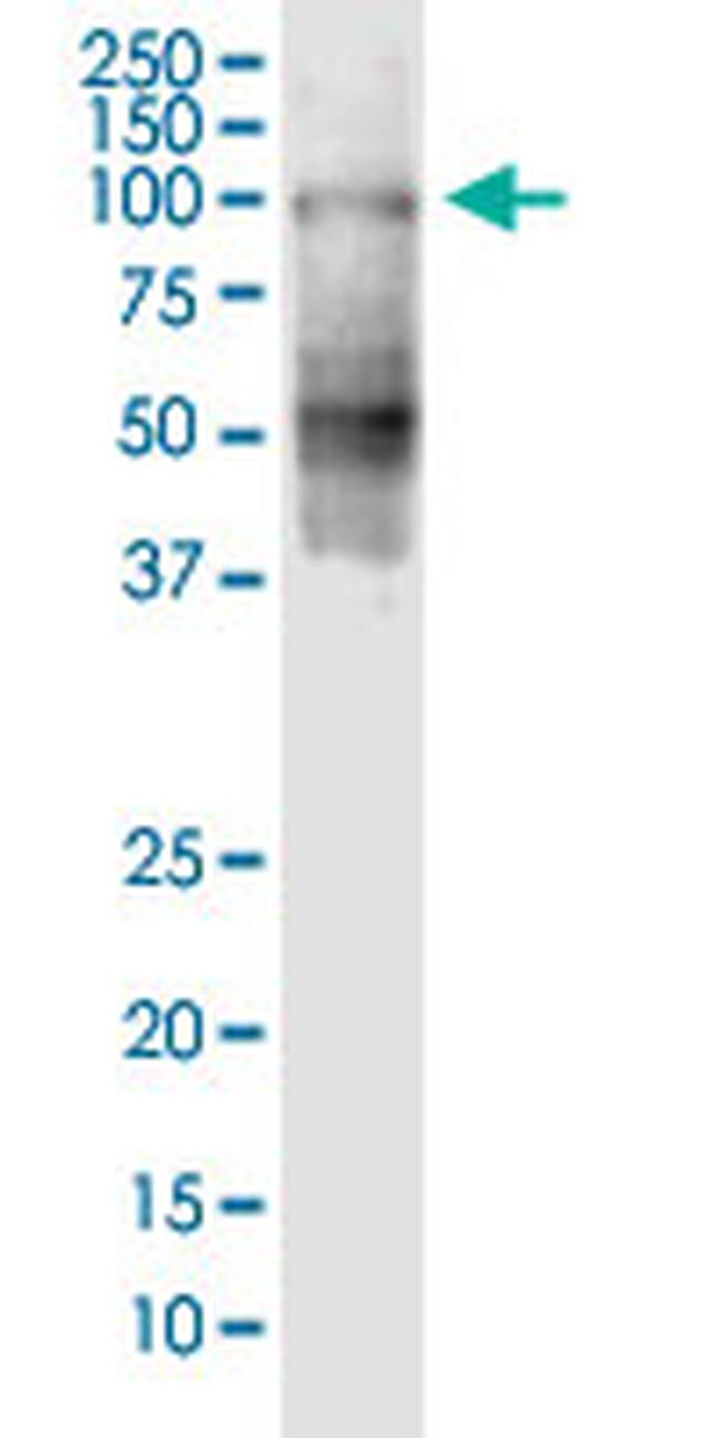 SHCBP1 Antibody in Western Blot (WB)