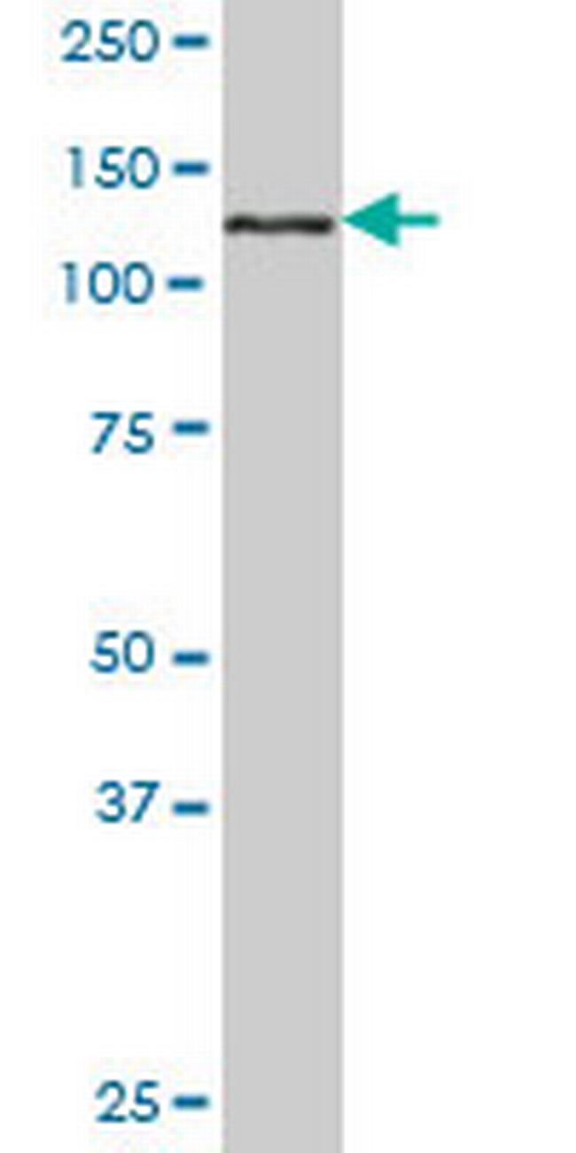 EHMT1 Antibody in Western Blot (WB)