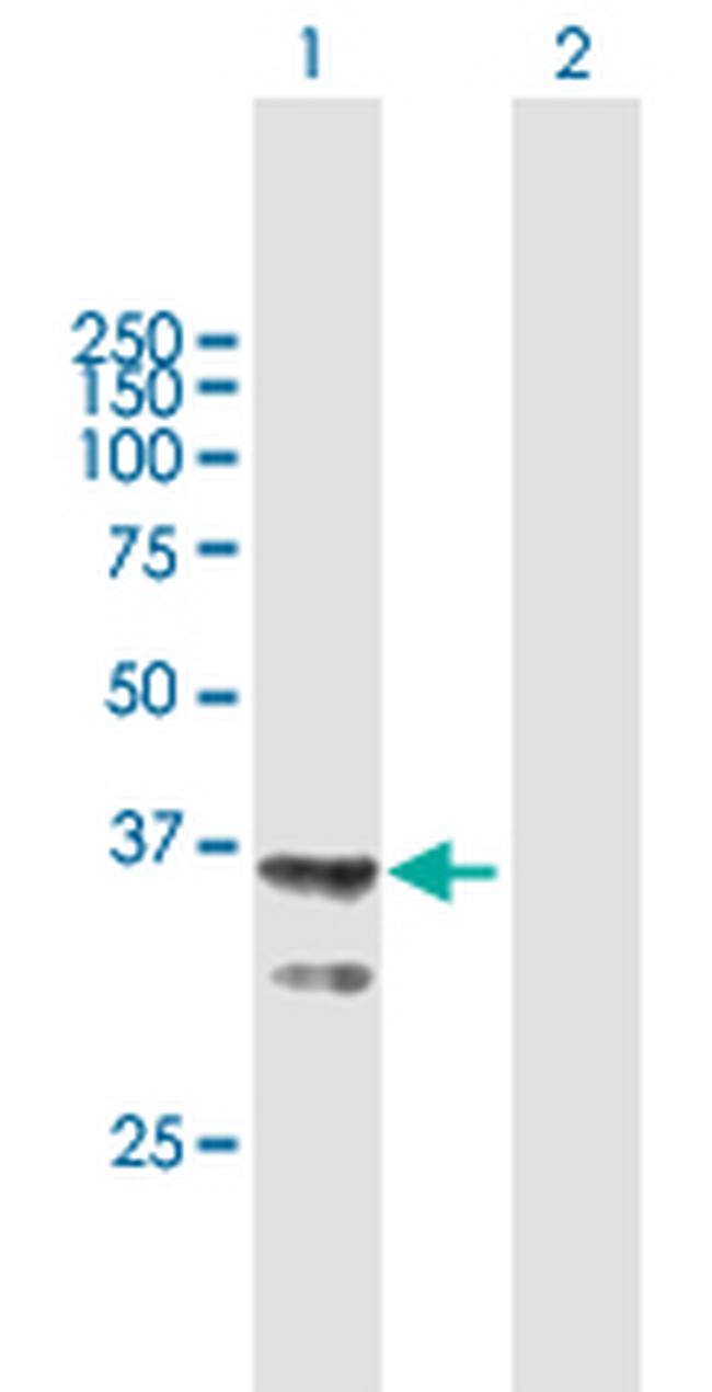 AGMAT Antibody in Western Blot (WB)