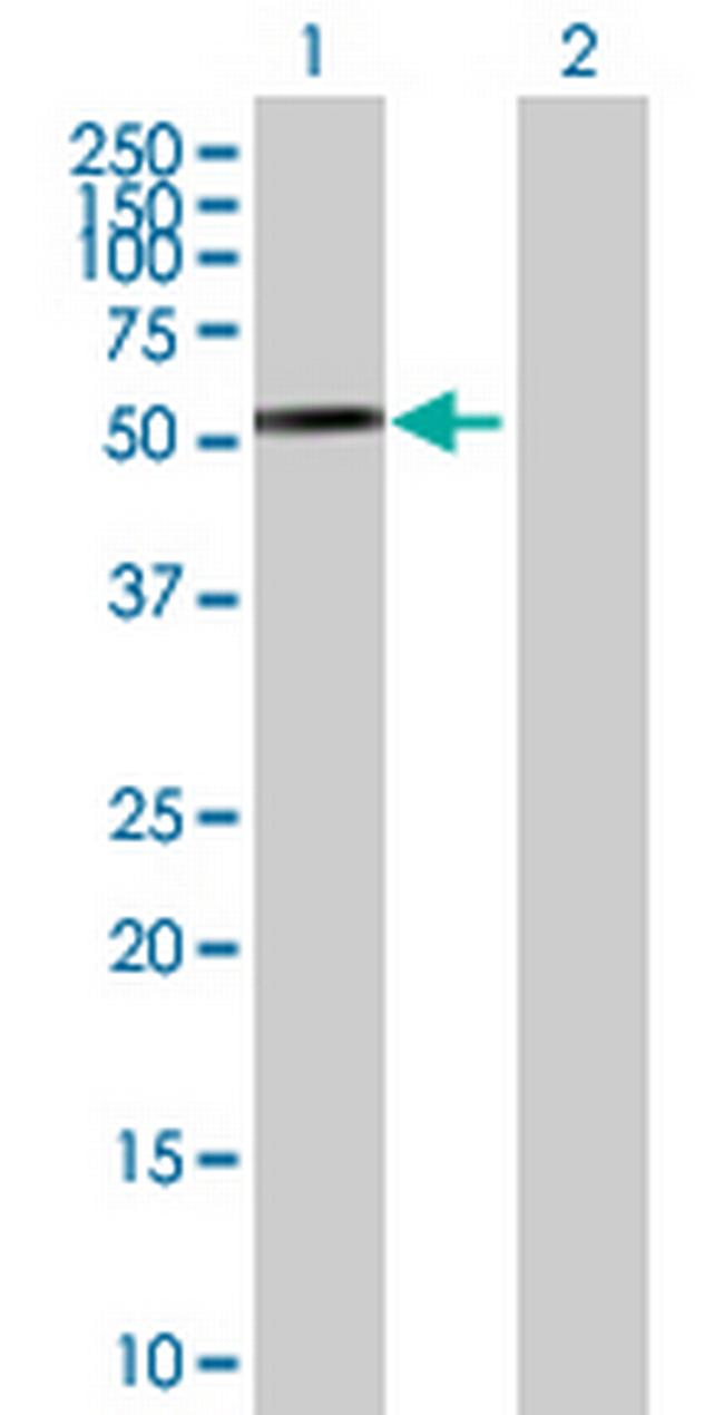 PDZD3 Antibody in Western Blot (WB)