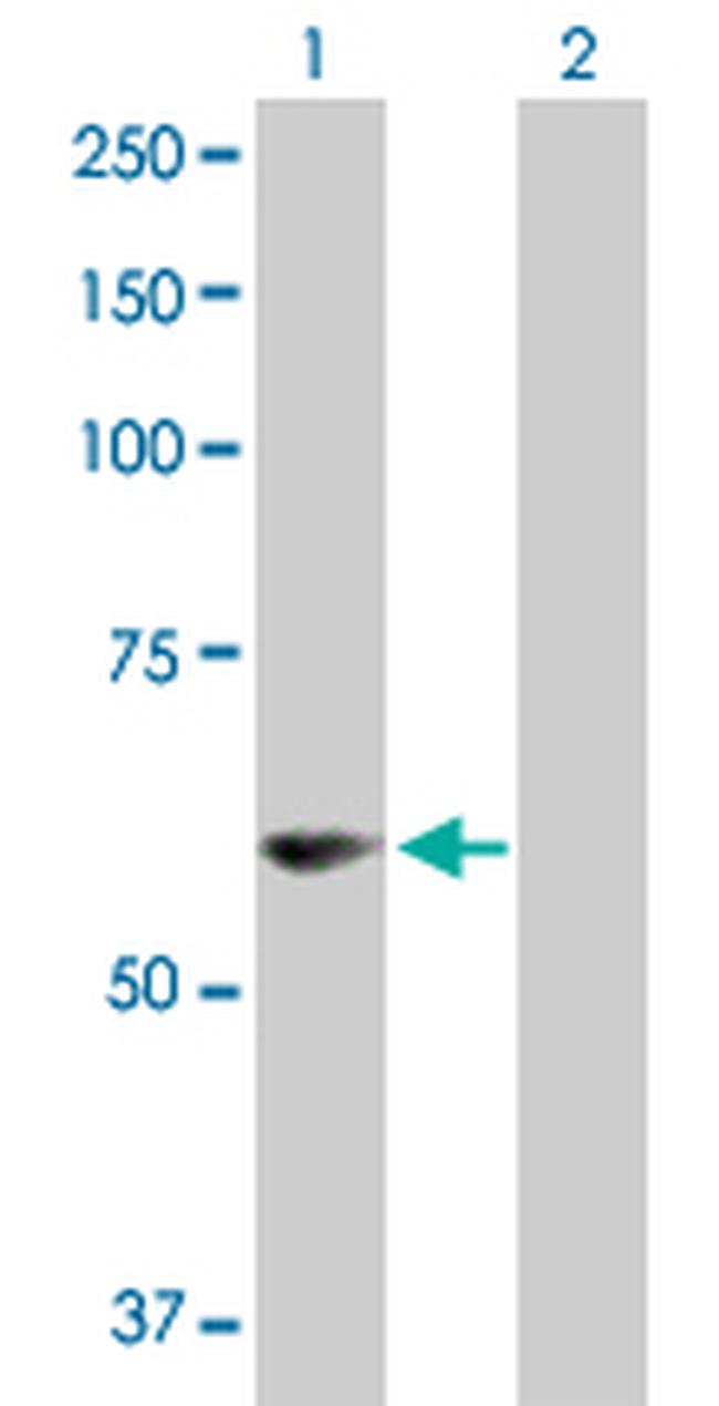 PDZD3 Antibody in Western Blot (WB)