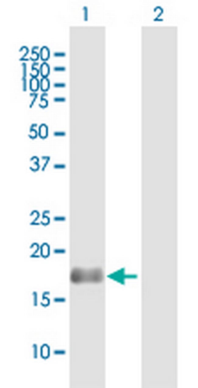 BAALC Antibody in Western Blot (WB)