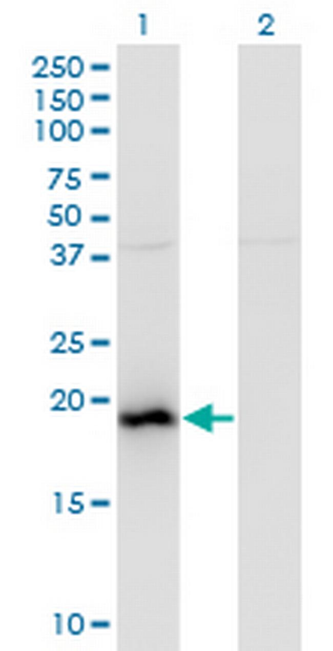 BAALC Antibody in Western Blot (WB)