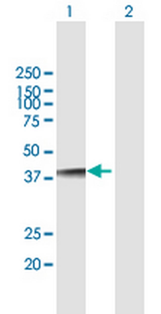 NUDT18 Antibody in Western Blot (WB)