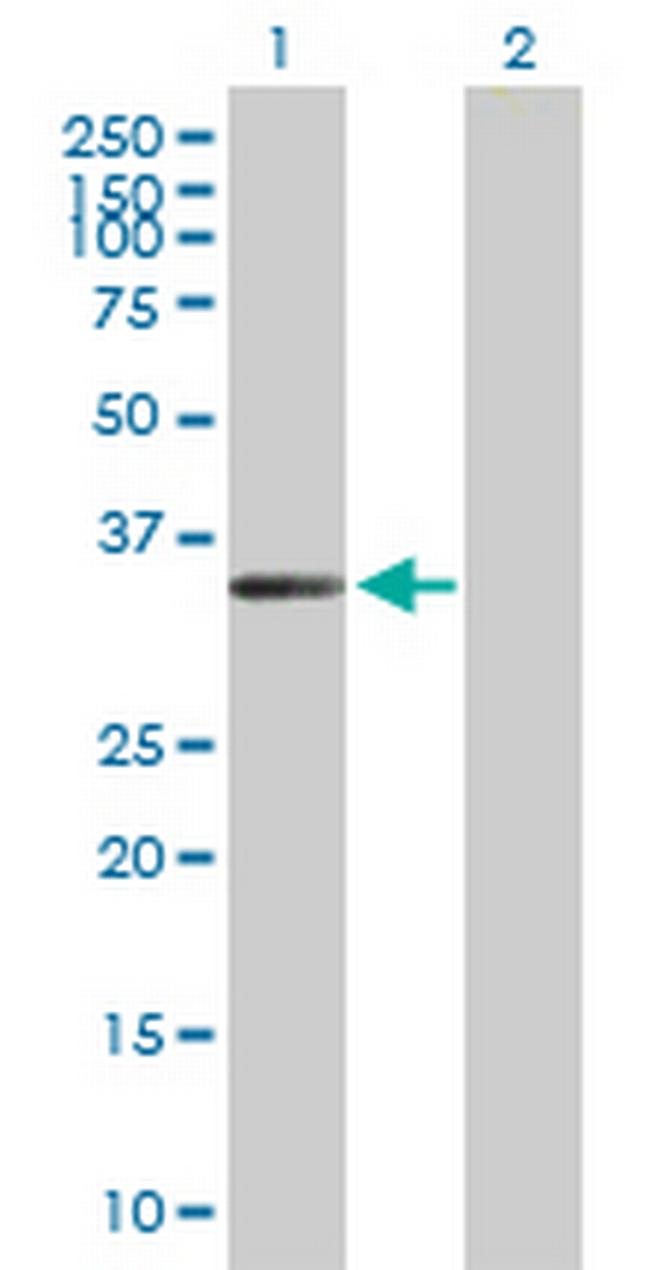 FLJ11806 Antibody in Western Blot (WB)