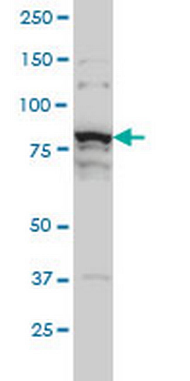 THNSL1 Antibody in Western Blot (WB)