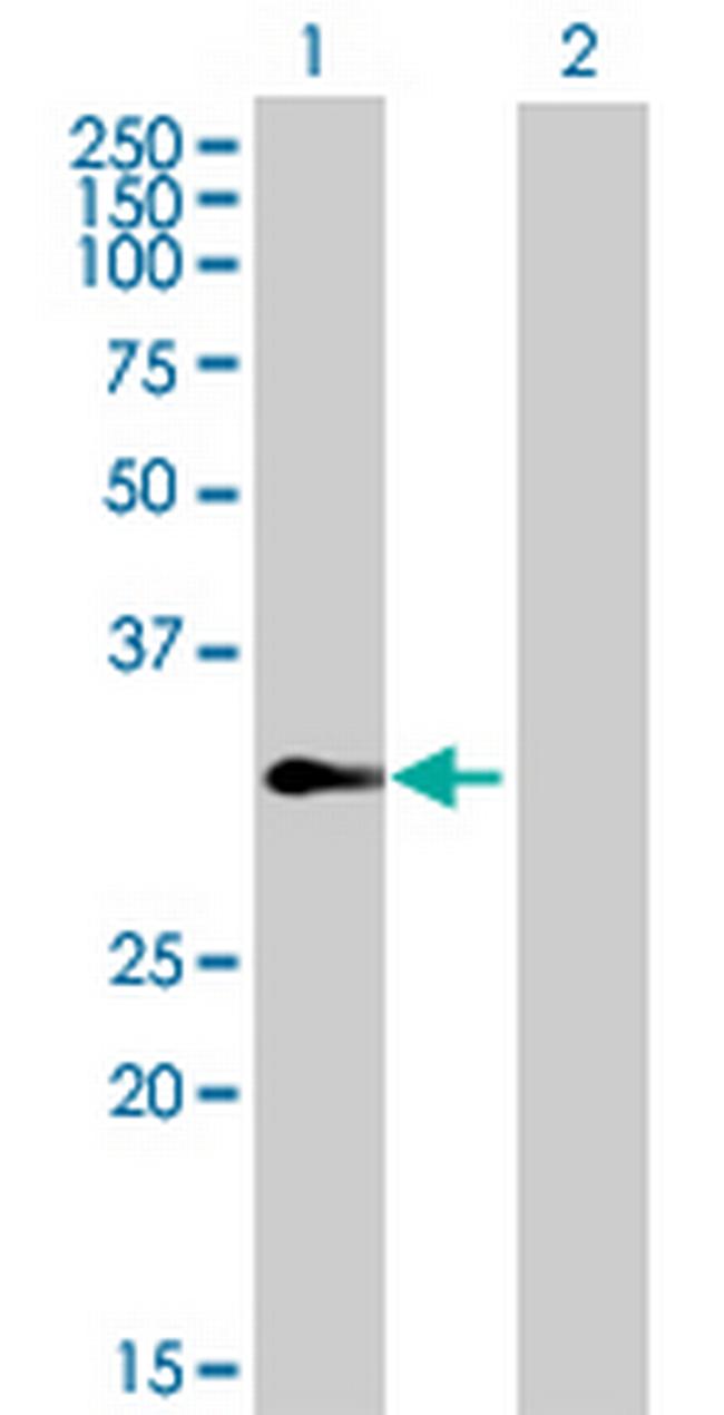 TCEAL4 Antibody in Western Blot (WB)