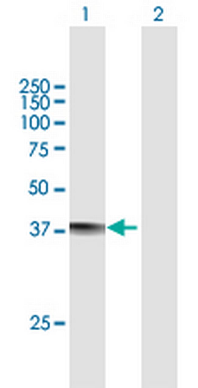 MRM1 Antibody in Western Blot (WB)