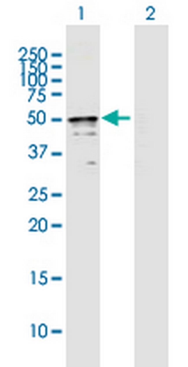 TRMT2B Antibody in Western Blot (WB)