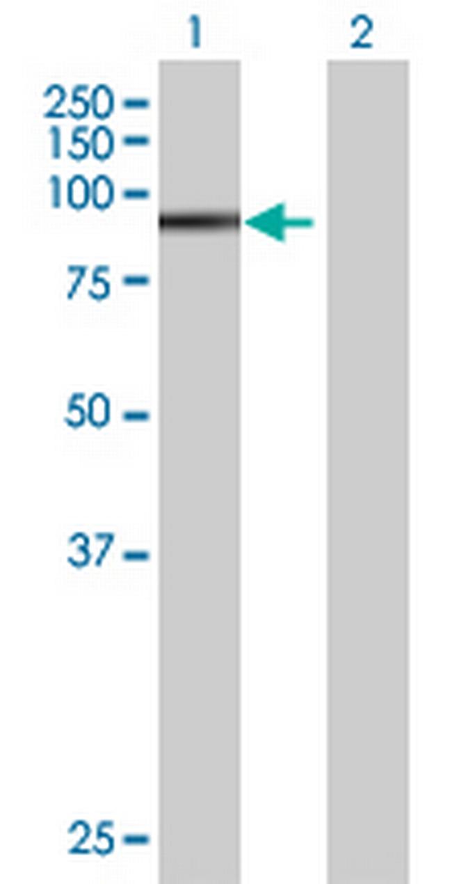 ZNF606 Antibody in Western Blot (WB)