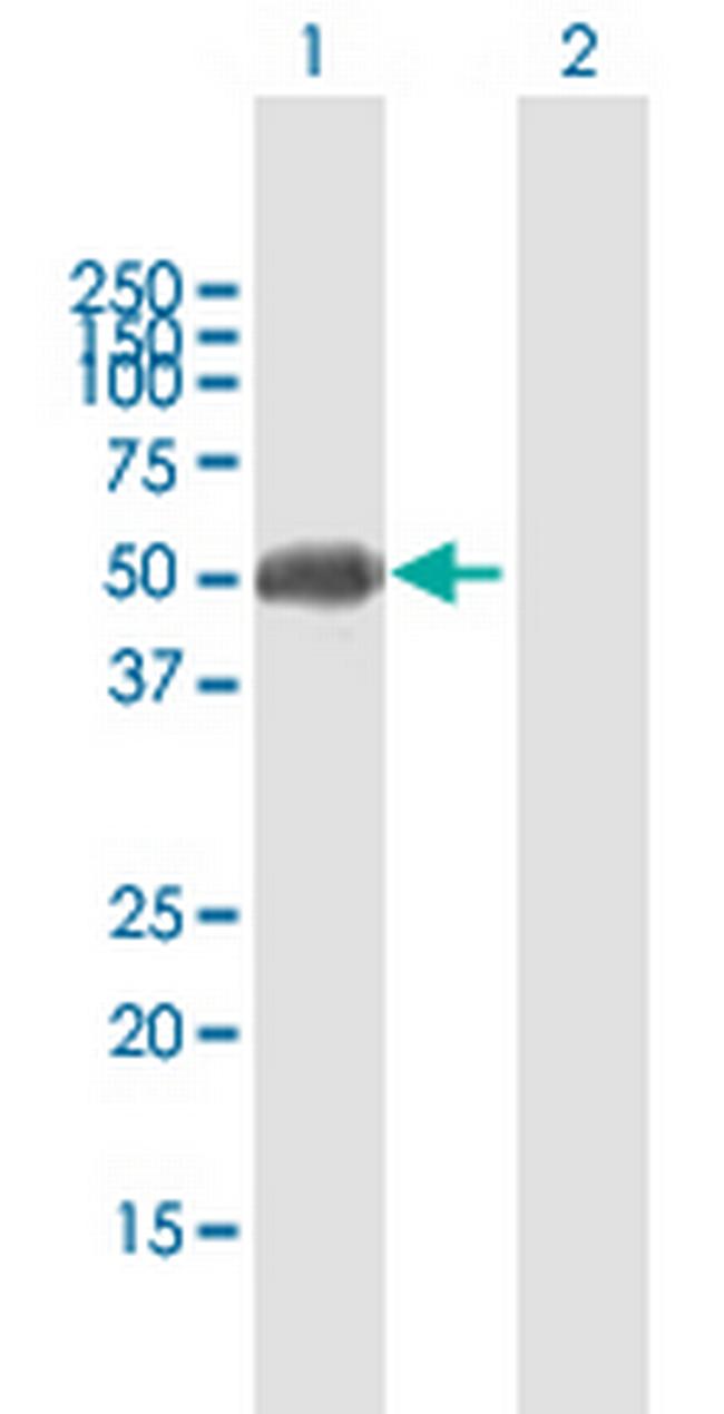 ZFP2 Antibody in Western Blot (WB)