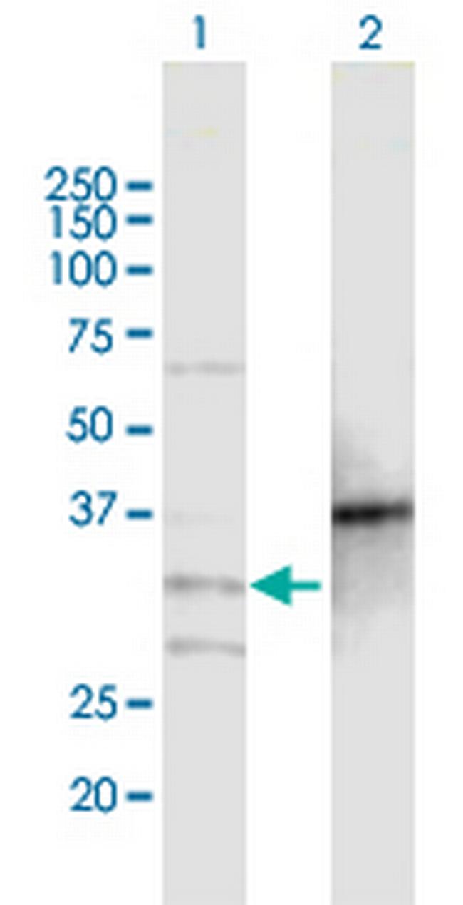 MOGAT2 Antibody in Western Blot (WB)